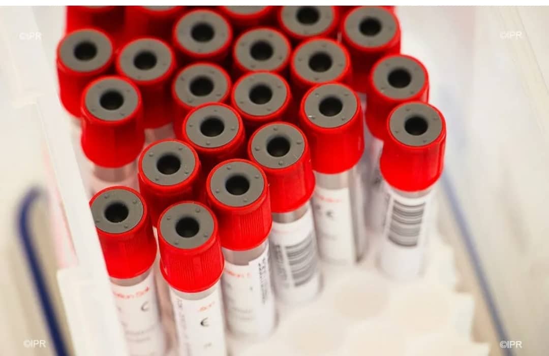 image Un cas de variole de singe à Mayotte: Une réunion d’urgence à Moroni