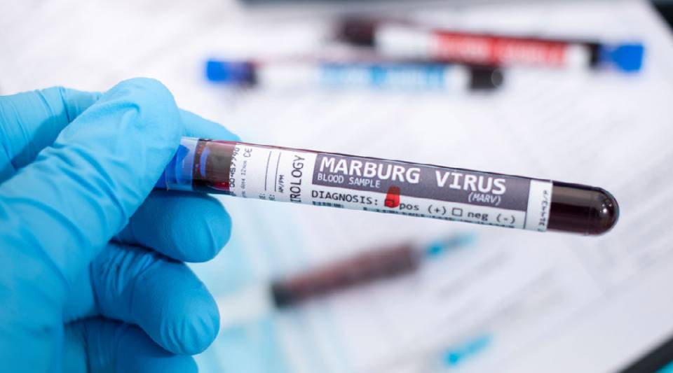 image Virus Marburg en Tanzanie :  Le pays suit de près la situation
