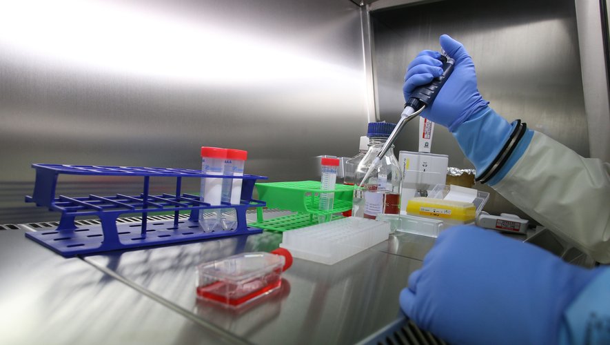 image Epidémie de fièvre hémorragique :  28 échantillons seront envoyés à l’IPM de Madagascar